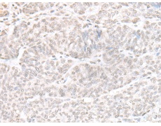 兔抗GPBP1L1多克隆抗体
