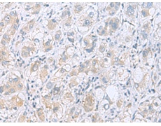兔抗GPCPD1多克隆抗体