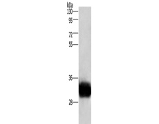 兔抗GPM6A多克隆抗体