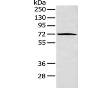 兔抗PLK3多克隆抗体