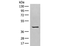 兔抗GPR62多克隆抗体