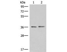 兔抗POLR3F多克隆抗体