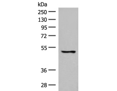 兔抗GPR152多克隆抗体