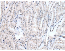 兔抗PPP1R42多克隆抗体