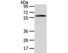 兔抗PPP5C多克隆抗体