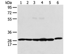 兔抗PRDX4多克隆抗体