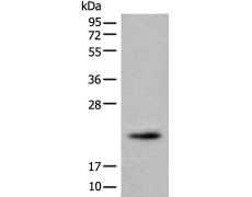 兔抗PRXL2B多克隆抗体