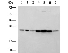 兔抗PSMB2多克隆抗体