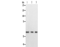 兔抗PSMD3多克隆抗体