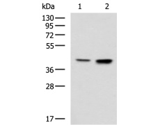 兔抗CSNK2A2多克隆抗体