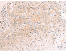兔抗PTCD3多克隆抗体