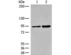 兔抗DDHD1多克隆抗体