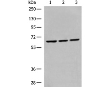 兔抗DDX56多克隆抗体