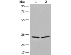 兔抗DIMT1多克隆抗体