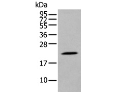 兔抗DUSP3多克隆抗体