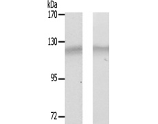 兔抗PTK2(Ab-843)多克隆抗体