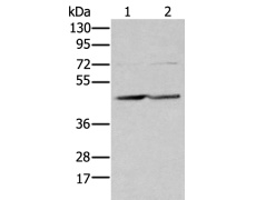 兔抗EFNB3多克隆抗体