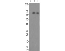 兔抗PTK2B(Phospho-Tyr579)多克隆抗体