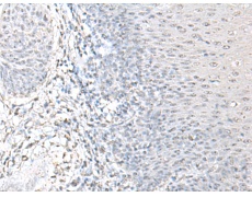 兔抗EPM2A多克隆抗体