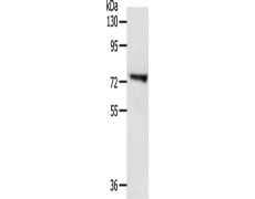 兔抗TRIM32多克隆抗体