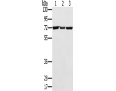 兔抗SLC25A13多克隆抗体
