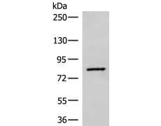 兔抗SLC26A3多克隆抗体