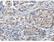 兔抗SMC1A多克隆抗体