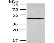 兔抗SMYD2多克隆抗体