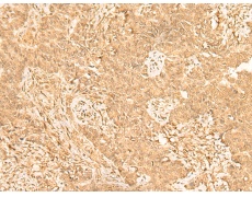 兔抗ST8SIA4多克隆抗体