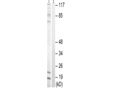 兔抗STMN1(Phospho-Ser62) 多克隆抗体