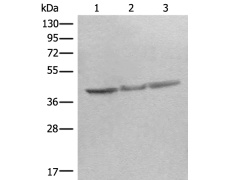 兔抗STOML2多克隆抗体