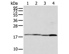 兔抗TIMM17A多克隆抗体