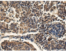 兔抗TMPRSS11D多克隆抗体