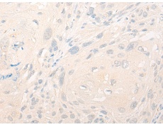 兔抗TNFSF11多克隆抗体