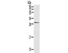 兔抗TNFSF15多克隆抗体