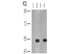 兔抗TP53 (Phospho-Ser6)多克隆抗体