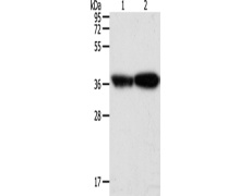 兔抗TPM2多克隆抗体