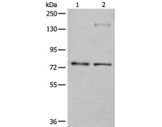 兔抗ATF6B多克隆抗体