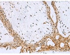 兔抗BCL7B多克隆抗体