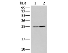 兔抗NAA10多克隆抗体