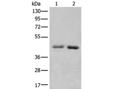 兔抗NADK2多克隆抗体 