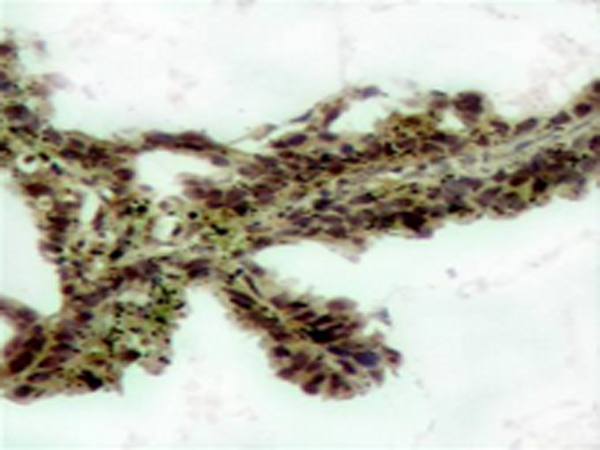 兔抗AKT1 (Phospho-Thr308)多克隆抗体
