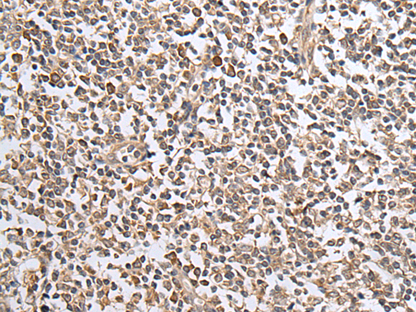 兔抗CXCL1多克隆抗体