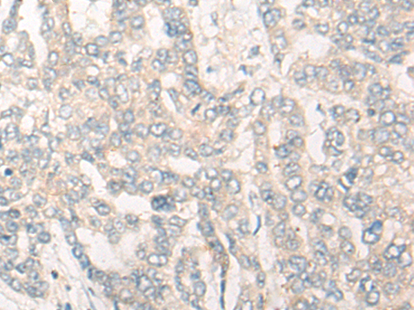 兔抗CYP26B1多克隆抗体