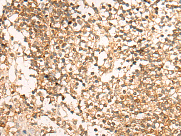 兔抗DACT1多克隆抗体