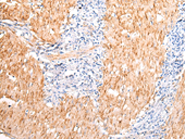 兔抗DMBT1多克隆抗体