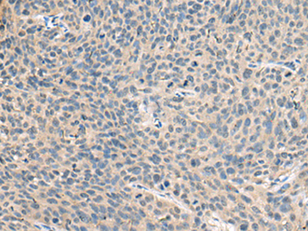 兔抗RNASE1多克隆抗体