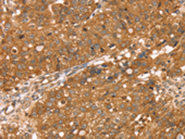兔抗RNASET2多克隆抗体