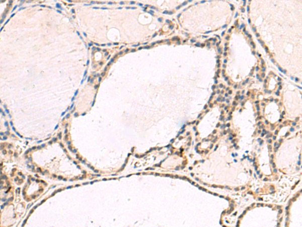 兔抗RNF13多克隆抗体