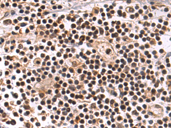 兔抗RNF114多克隆抗体